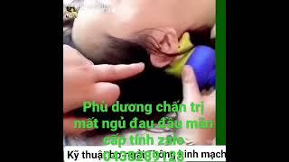 TRỊ ĐAU ĐẦU ĐÔNG Y/TRỊ MẤT NGỦ ĐÔNG Y/MASSAGE TRỊ LIỆU ĐÔNG Y