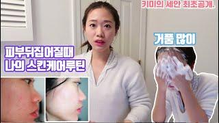 지복합 여드름 피부 나의 스킨케어 루틴 [피부뒤집어졌을때] Skincare routine for combination skin!