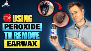 Stop Using Hydrogen Peroxide to remove Earwax!