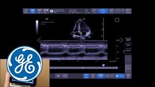 Venue Ultrasound Tutorial: Optimizing M-Mode | GE Healthcare