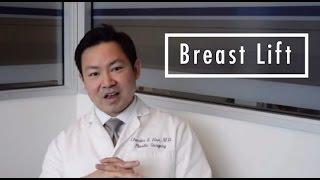 Breast Lift (Mastopexy) Frequently Asked Questions