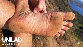 How I Transformed My Feet By Going Barefoot   | UNILAD Adventure