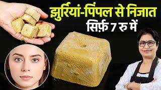 काले घेरे और मुंहासे सभी का 1 रामबाण इलाज करेगी ये जादुई मिट्टी -  Multan Mitti - 5 Days Face Pack