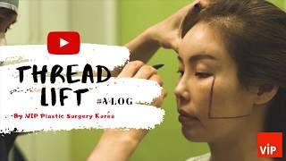 Thread Lift V-Log | VIP Plastic Surgery Clinic Korea