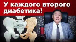 Спасаем хрупкие кости! Остеопороз у диабетика