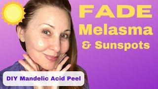 Fade Melasma & Sunspots on a Budget