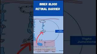Flourescein Leakage indicates breakdown of the Blood Retinal Barrier