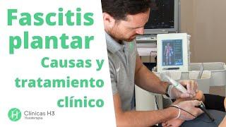 Fascitis plantar, tratamientos  [Efectivos ] y síntomas. Cómo se cura 