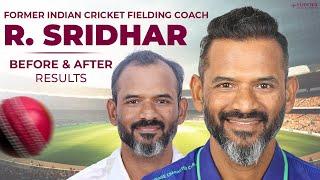 Former Indian cricketer R Sridhar's Hair Transplant - Before and After Results at Eugenix