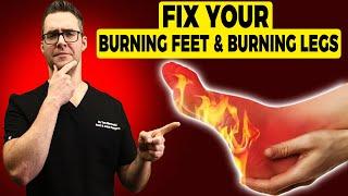 Burning Legs & Burning Feet at Night [Treatment & Home Remedies]