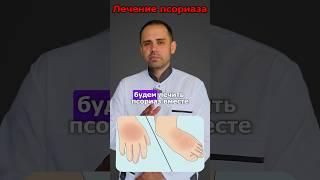 Лечение псориаза 