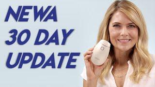 NEWA Radio Frequency Device 30 Day Update Before and After - Over 40