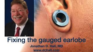 Fixing the Gauged Earlobe