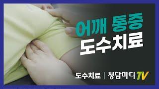 어깨통증 도수치료_오십견, 석회성건염, 회전근개파열_청담마디신경외과 도수재활센터