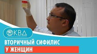 Вторичный сифилис у женщин. Клинический случай №35