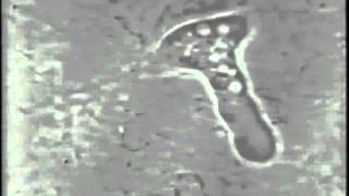 Dr. Thomas McCawley, Periodontist in Fort Lauderdale, FL Amoeba Clip