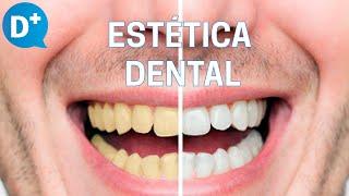 ¿Cuáles son los principales tratamientos de Estética Dental?