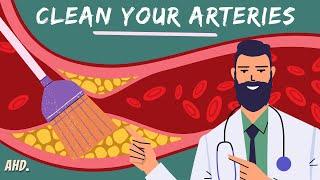 Top 10 Foods To Unclog Arteries Naturally & Prevent Heart Attack