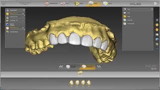 1 to 1 Copy Mode - inLab SW - Dentsply Sirona