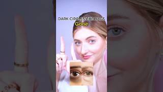 how to remove dark circles and eye bags? #darkcircles #eyebags #facemassage #faceyoga #faceexercise