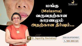 மங்கு Malasma வருவதற்கான காரணமும் அதன் தீர்வும்...  | Tamira Life