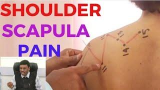 SHOULDER SCAPULA PAIN