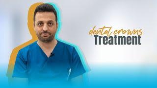 Dental Crowns Treatment | INCI DENTAL CLINIC