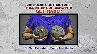 Capsular Contracture