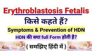 Erythroblastosis Fetalis किसे कहते हैं?Hemolytic Disease of a Newborn in hindi|Symptoms & prevention