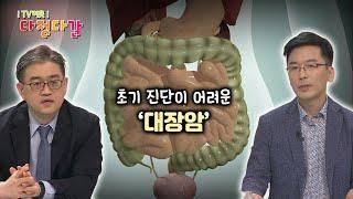 ‘의학 알지’ 대장암 X 대장암 발병 원인 / KBS대전 20210527 방송