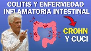 COLITIS y ENFERMEDAD INFLAMATORIA INTESTINAL (Crohn y CUCI)