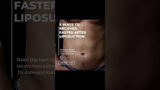 Liposuction Recovery Tips by Dr Ashwani Kumar