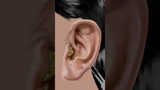 #asmr Itchy & Smelly Ear Stone Removal #animation #beauty #ear