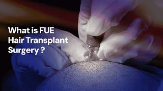 What is FUE Hair Transplant Surgery ?