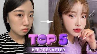 Top 5 plastic surgery transformations at NANA Hospital