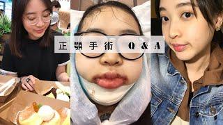 我的正顎手術 My Double Jaw Surgery