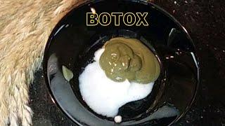 The best moisturizing Botox cream for skin wrinkles and sagging skin. Removes wrinkles!