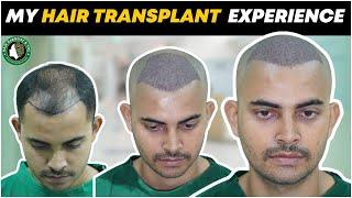 Best Hair Transplant in Guwahati | Best Hair Transplant Result & Cost in Guwahati