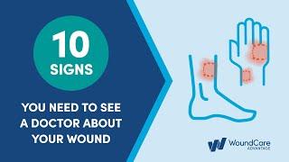 10 Signs you need to see a doctor for Wound Care