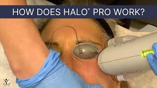 Improve Tone, Texture and More with Halo Pro Complete Skin Rejuvenation