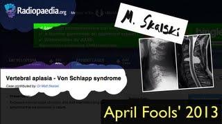 Radiopaedia.org April Fools' Case 2013 - Von Schlapp disease