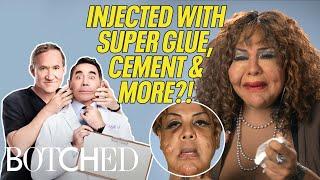 Rajee's EMOTIONAL Injection Removal & Facial Transformation (Before & After) | Botched | E!