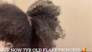 Scratching Scalp With Fingers| Tough Flakes| Itchy Scalp| Update With Princess