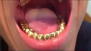 Gold Teeth Grillz