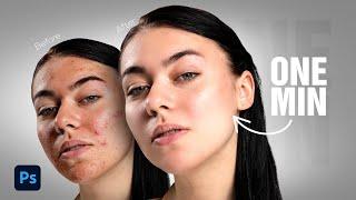 How to Remove Acne - Photoshop Tutorial For Beginners 2024 #photoshop