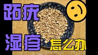 第35期  濕疹,跖疣,瘊子怎么办？介绍一种治疗的方法，一定要多试试。