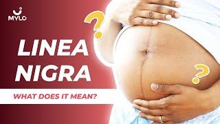 Linea Nigra | When Does Linea Nigra Appear? | What Does Linea Nigra In Pregnancy Mean? | Mylo Family