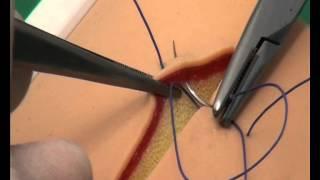 CSL: Vertical mattress suture pattern