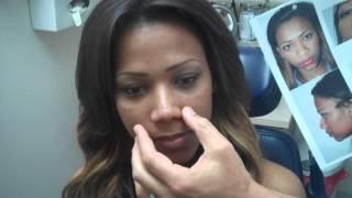 Ethnic Rhinoplasty | Miami Rhinoplasty | Dr. Jeffrey Epstein