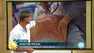 Plastikkirurgi – Doktor Mikael om risker och orealistiska förväntningar - Nyhetsmorgon (TV4)